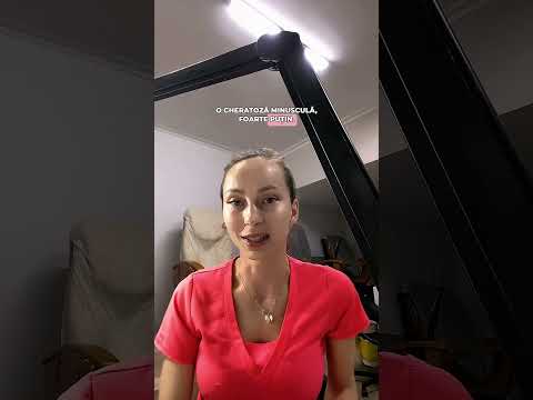 Încărcați videoclipul: