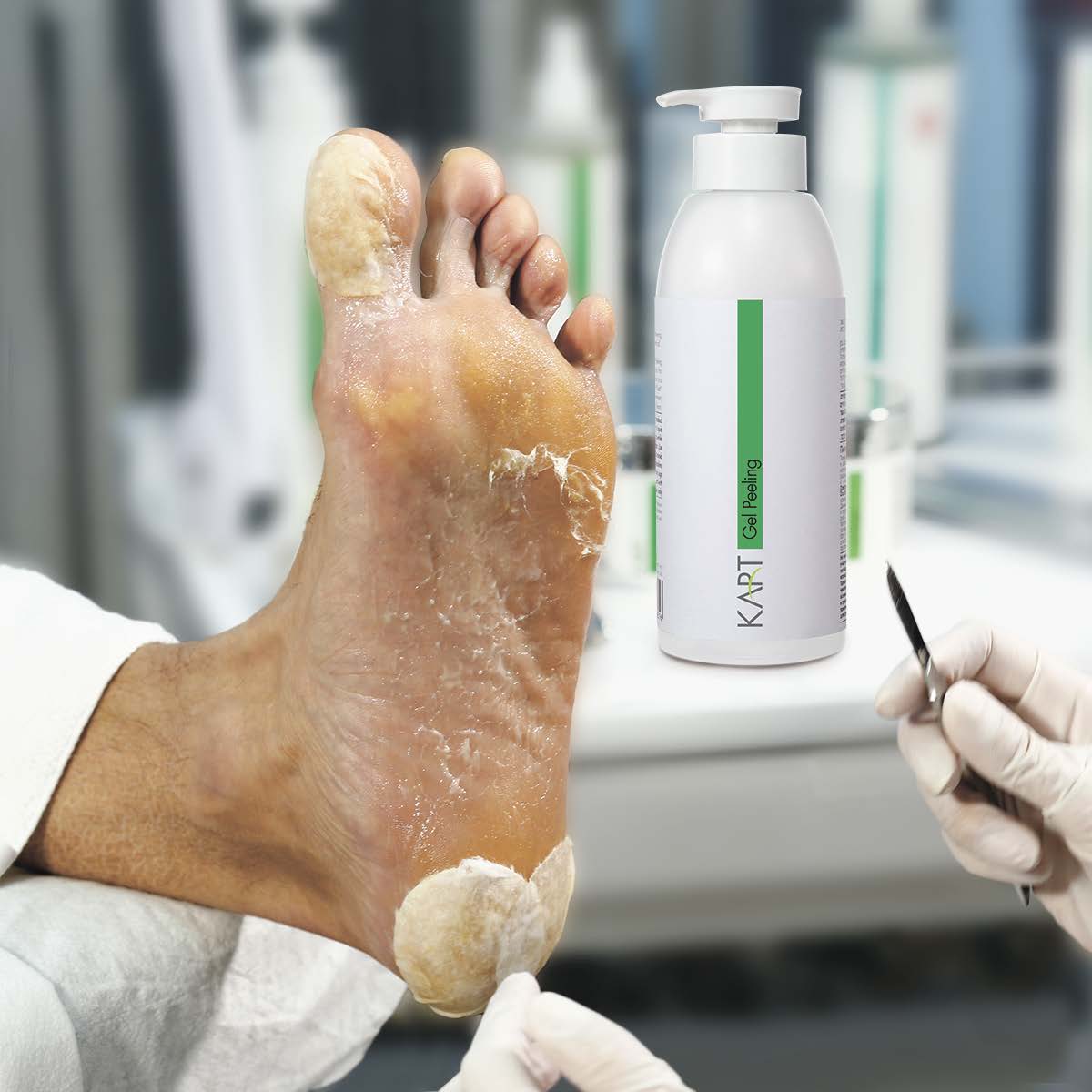 Extra Gel Remover Kart - 1000ml (7036)