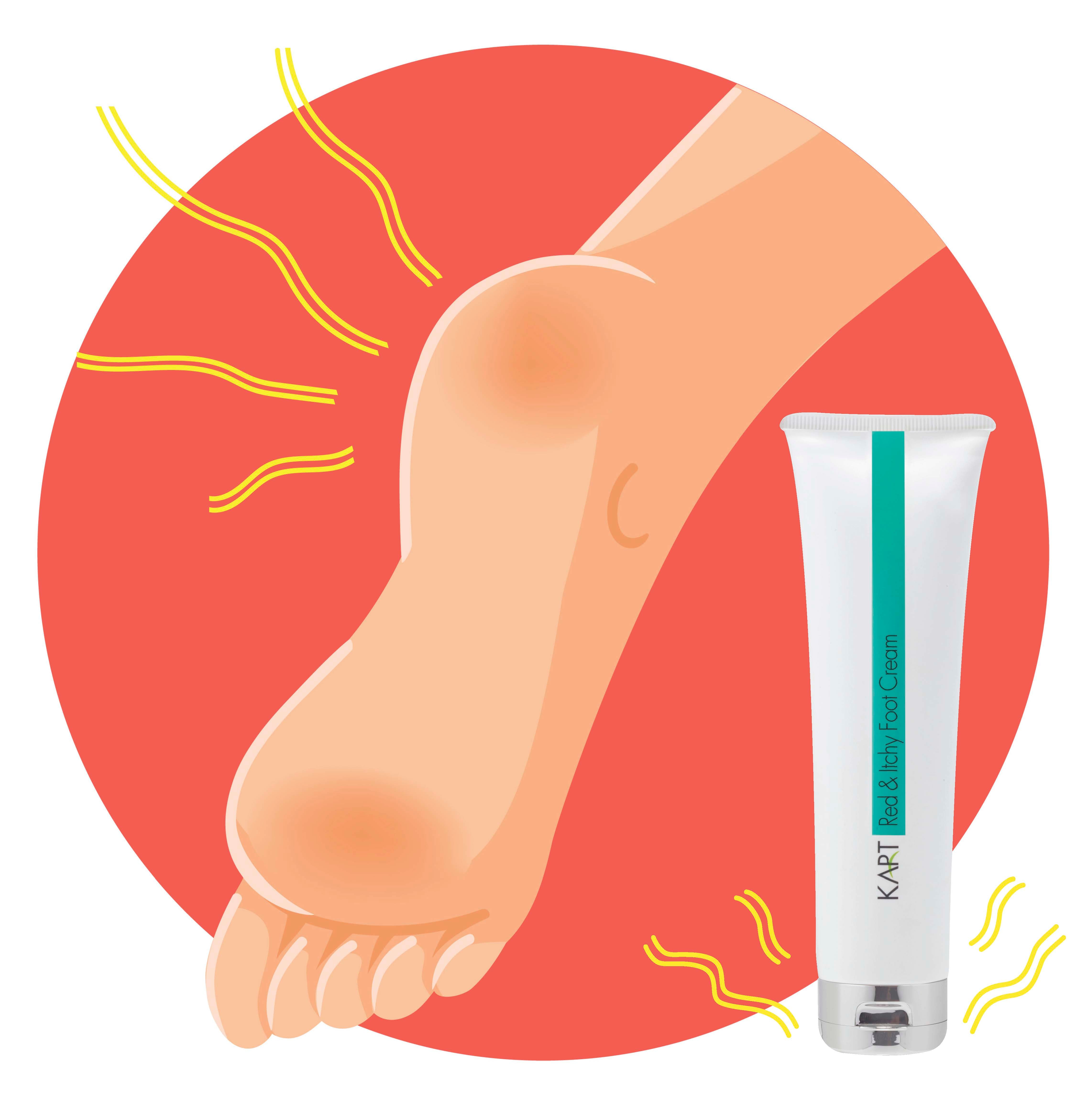 Red & Itchy Foot Cream Kart - 50ml (7705)