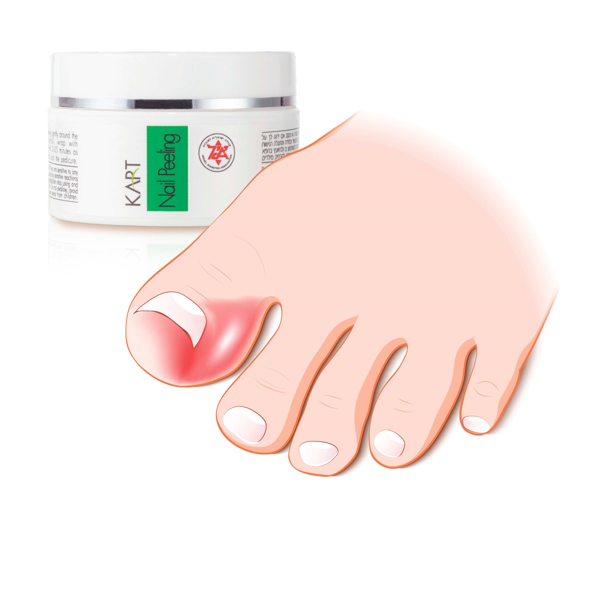 Nail Peeling Kart - 20ml (7003)
