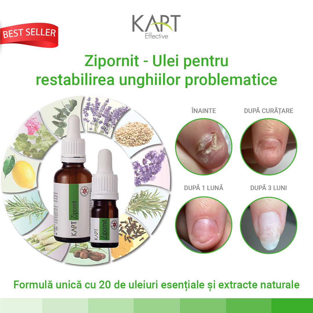 Zipornit Kart - 5ml (7005) - Annette Nails