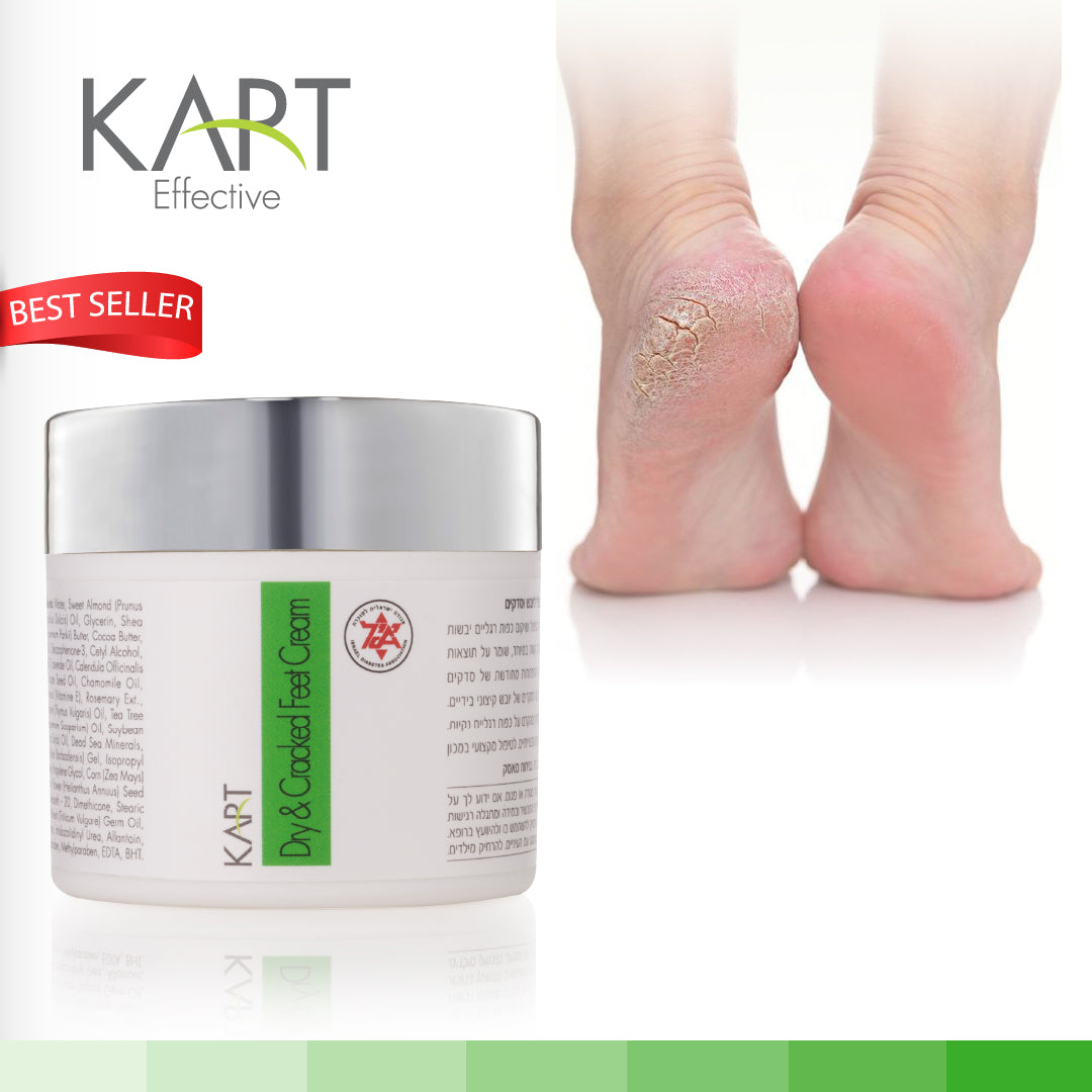 Dry and Cracked Feet Cream Mosc Kart - 50ml (7015) - Annette Nails